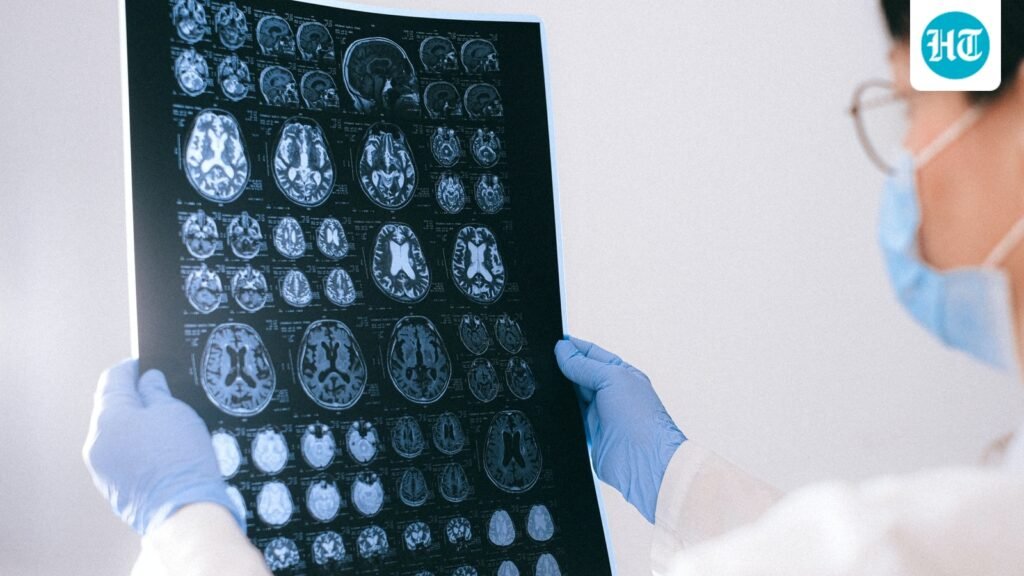 Do mobile towers cause brain tumours? Oncologist Dr Sunny Jain explains the truth about cellphone radiation