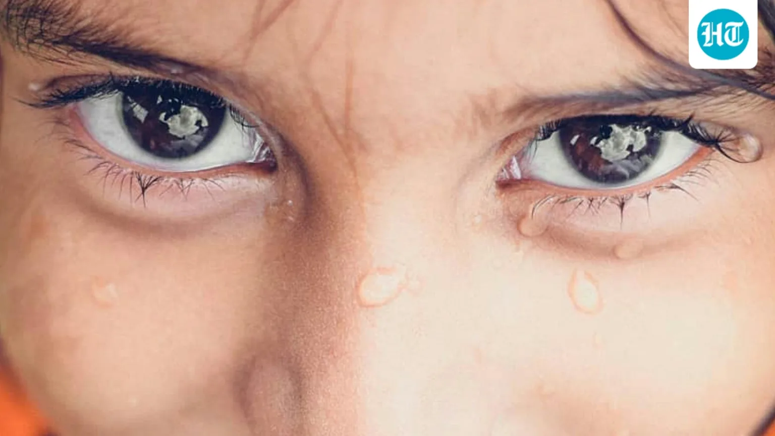 Living with ‘dancing eyes’: Bengaluru ophthalmologist explains misunderstood eye condition affecting millions of Indians