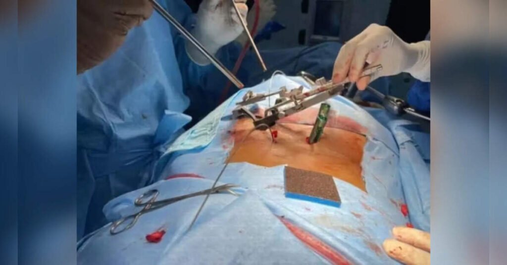 SGPGI develops safety device for complex paediatric spinal surgeries, ETHealthworld