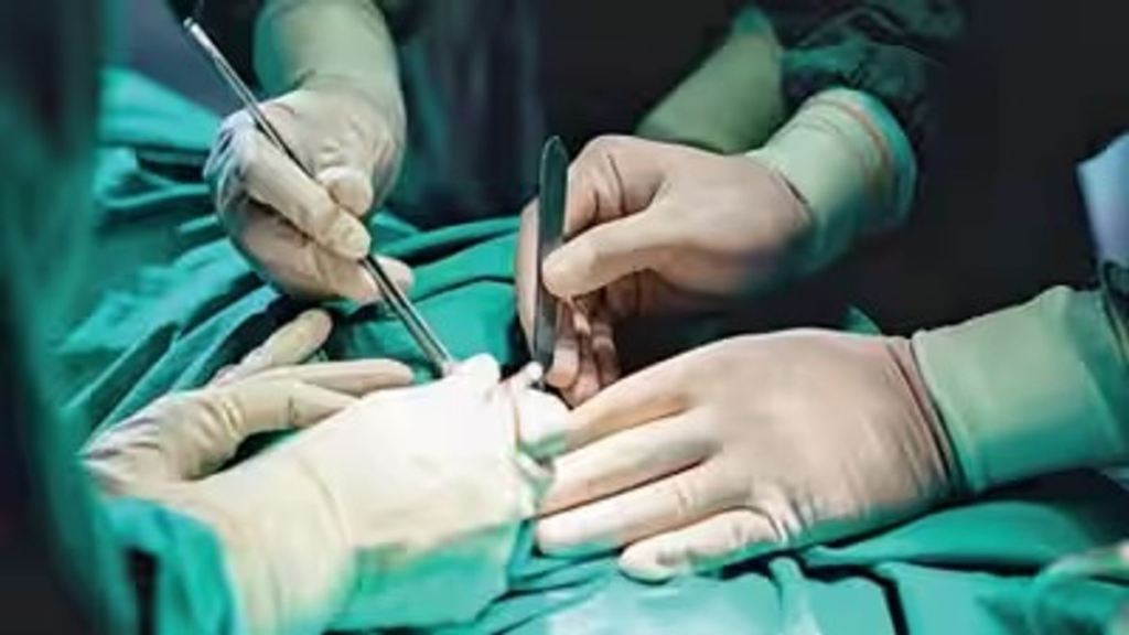 Complex ovarian cyst removed at Kangan hospital