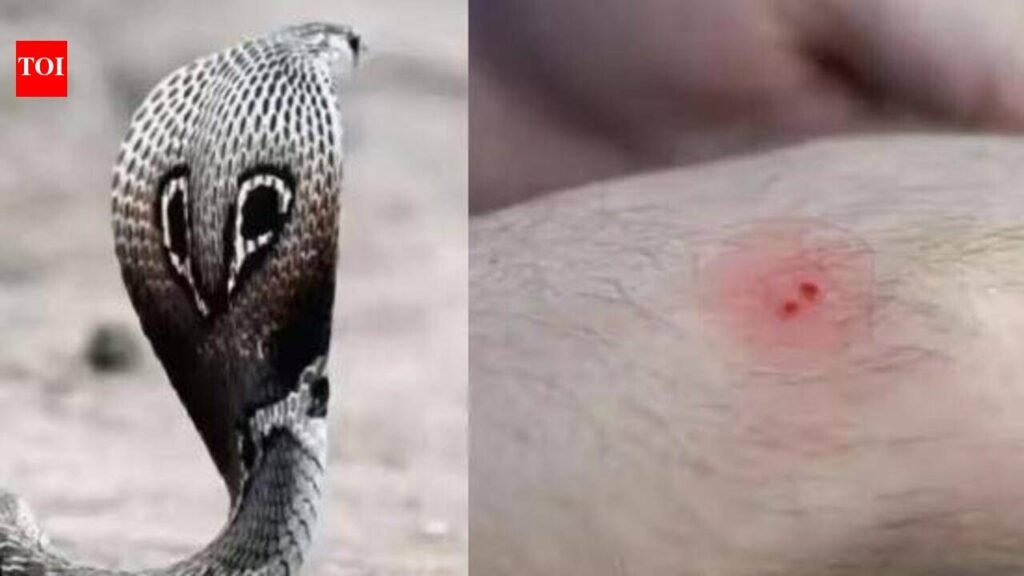 Snakebite deaths expose Tamil Nadu’s rural health gaps | Chennai News