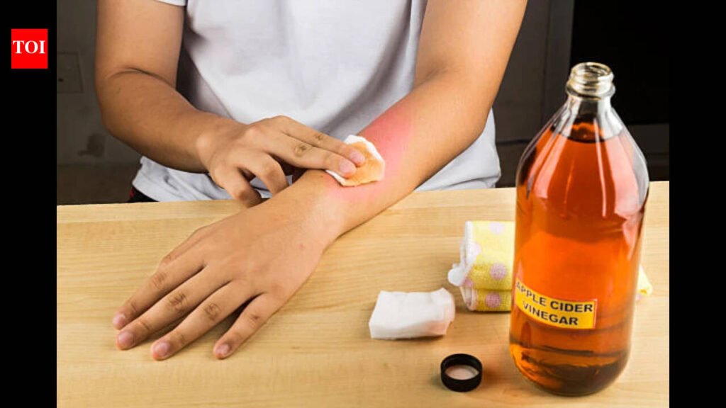 Is it safe to remove moles with apple cider vinegar?