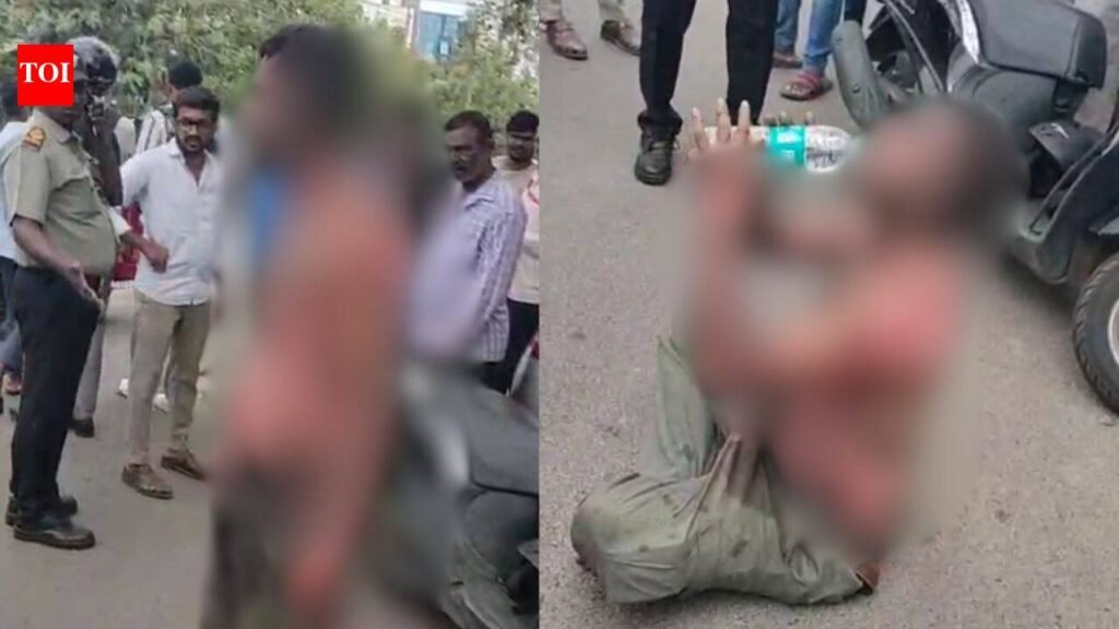 Youth immolates himself while asking diploma student to love him, attempts to hug her in Mysuru | Mysuru News