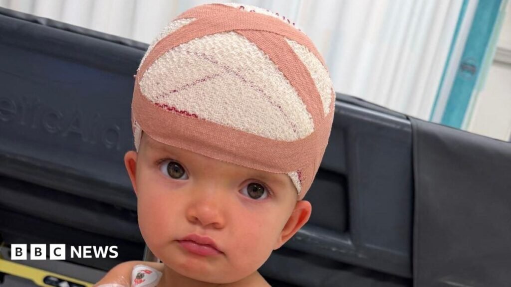 Leeds mum raising awareness of baby’s rare skull condition