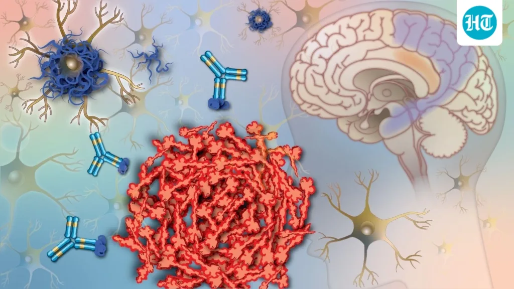 Is Alzheimer’s in your DNA? Doctors reveal what your family history actually means and whether you should get tested