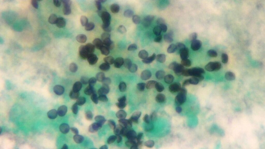 Fungus found evolving resistance to drug meant for humans