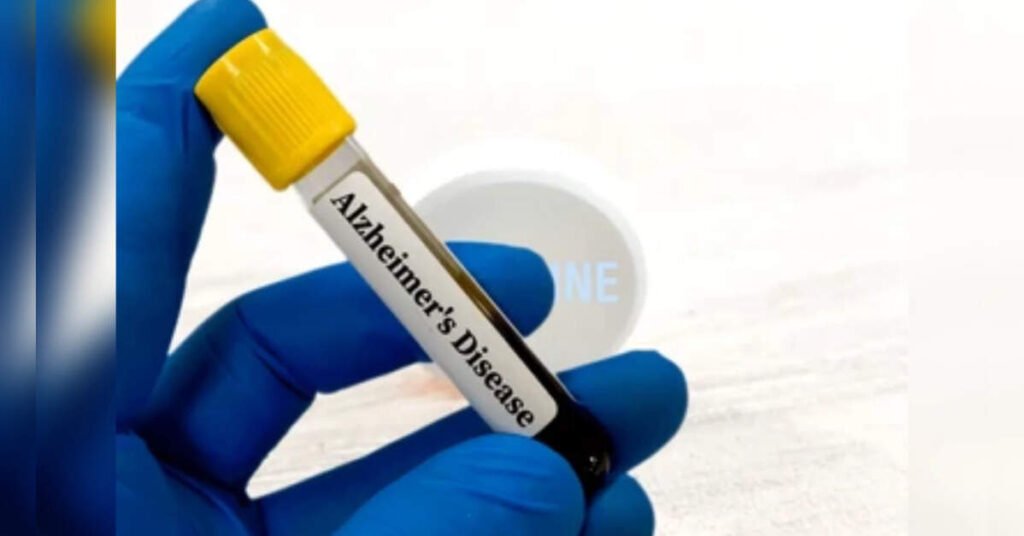 ALZpath Partners with Abbott for Breakthrough Alzheimer’s Blood Test, ETHealthworld