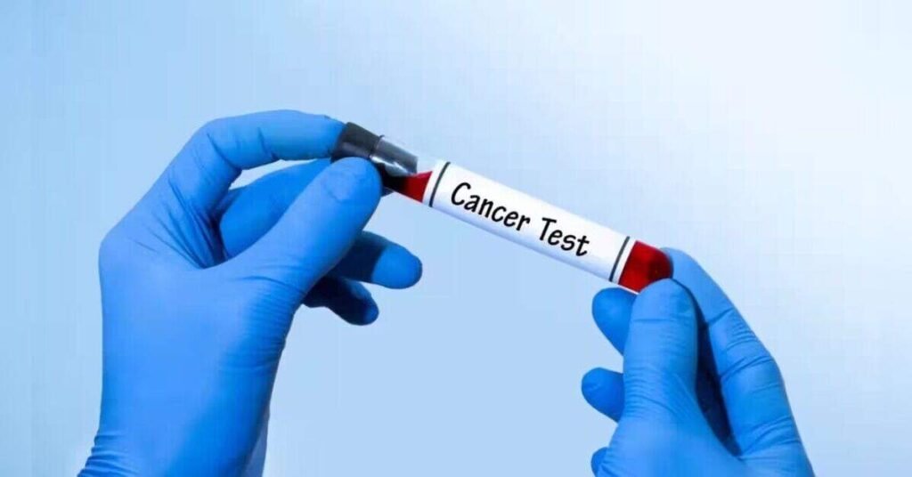 FDA Panel Supports Safety of Grail’s Galleri Cancer Test Amid Efficacy Debate, ETHealthworld