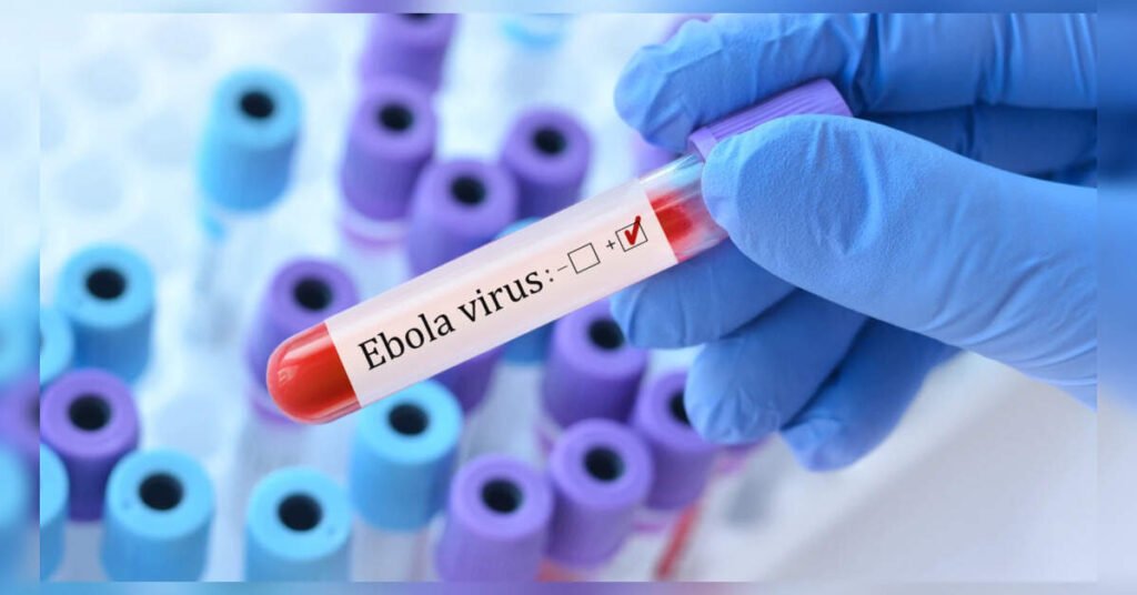 Ebola Epidemic Surpasses 6,000 Cases in Congo, Breaking Historical Records, ETHealthworld