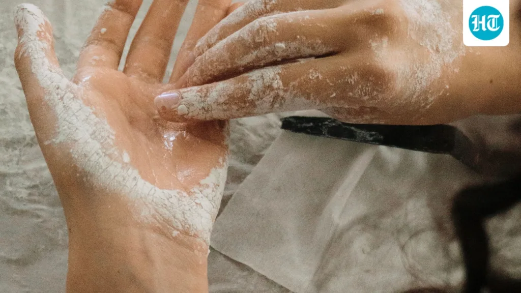 Burn at Home? Doctor shares what to do immediately and which home remedies to avoid