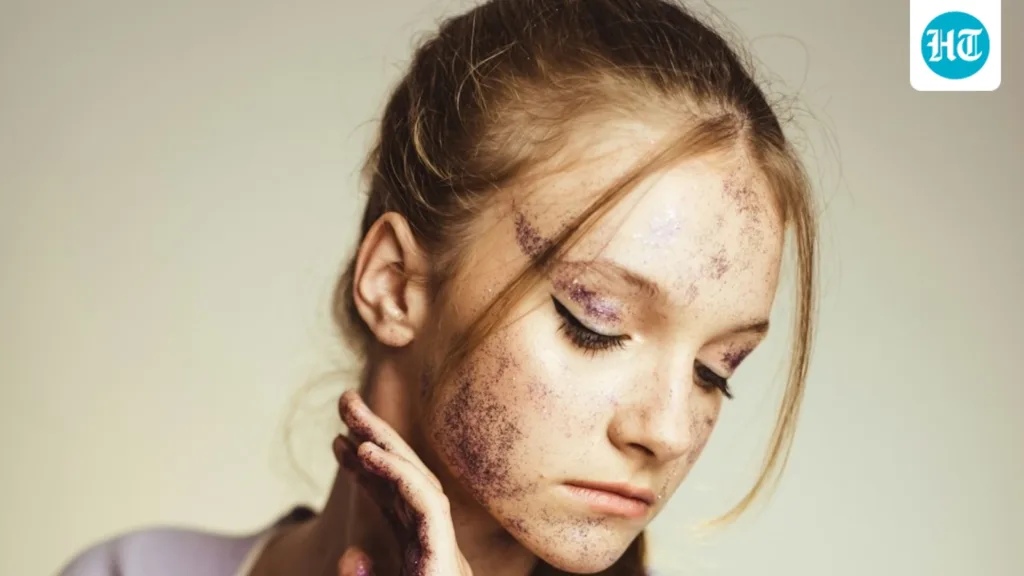 Not all acne scars are the same: How to identify your scar type and understand what your skin needs