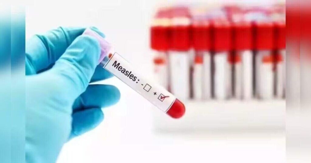 CDC Reports Alarming Surge in Measles Cases in 2026 with Over 3,100 Infections, ETHealthworld