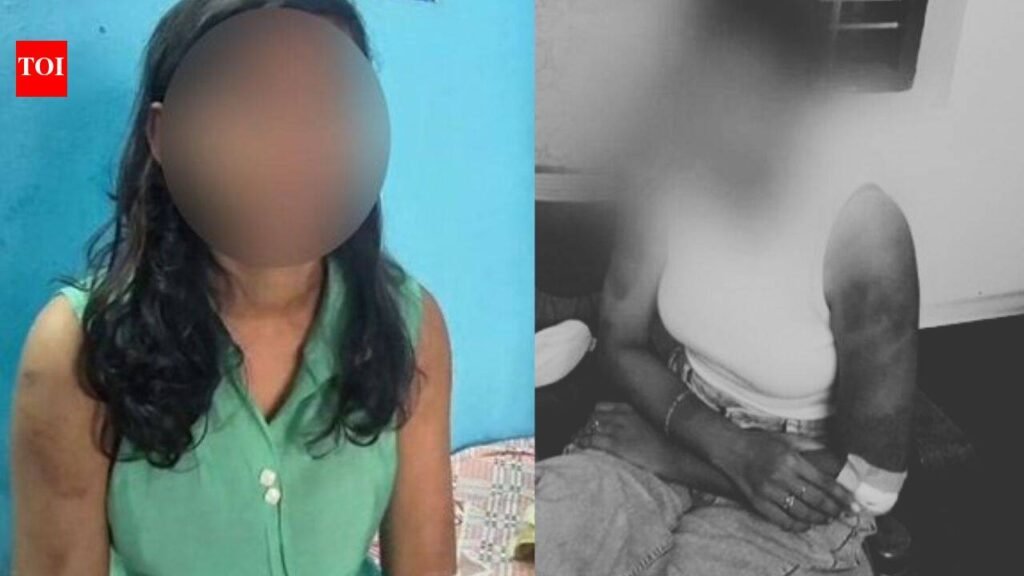 ‘Forced to say I wanted to work in sex racket’: Newlywed alleges dowry torture, assault by husband | Thiruvananthapuram News