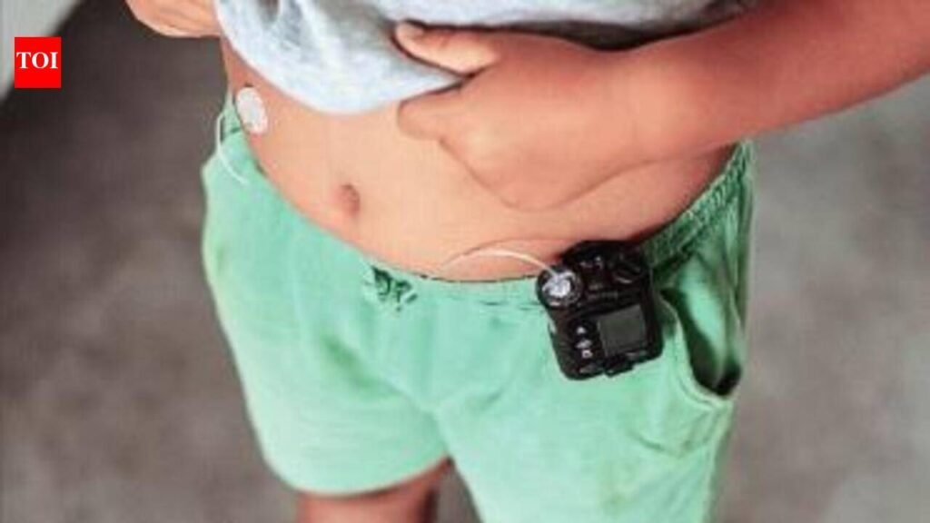 Childhood obesity spreads across income groups, Mumbai’s Wadia hospital sees 300 cases in 3 years | Mumbai News
