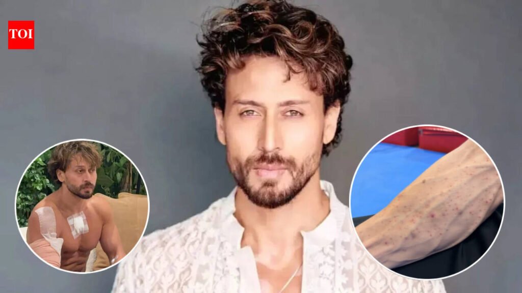 Tiger Shroff’s team shares video of gunpowder burn marks on his hand after firing incident: ‘God is kind’ | Hindi Movie News