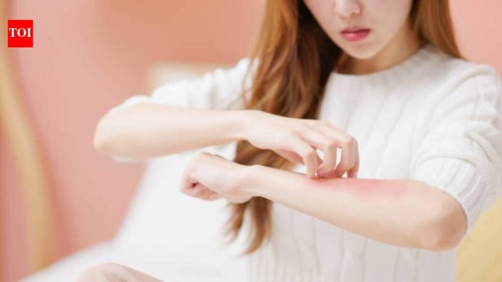 Dry Winter Skin Remedies: Dry winter skin? 5 gentle remedies that may help and 3 popular fixes to avoid