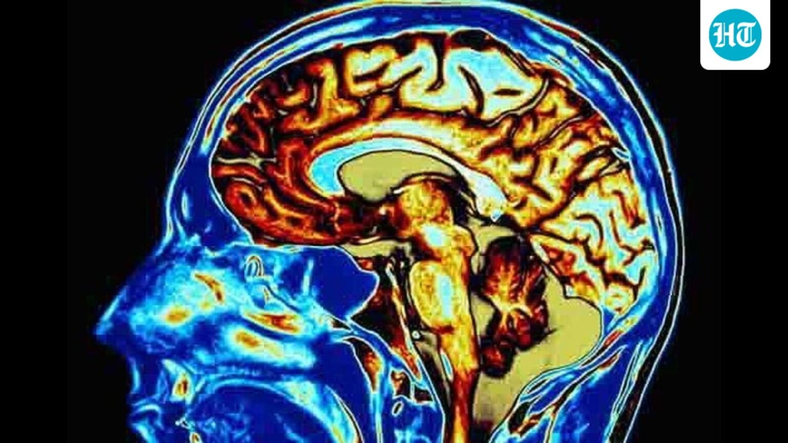 The heart attack we see, the brain we don’t