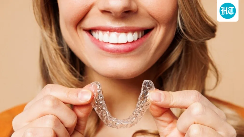 5 things to know about the rise of clear aligners and digital dentistry