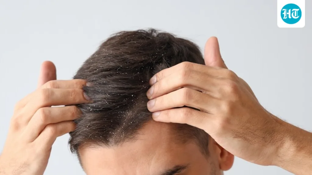 Your hair looks clean, but is your scalp healthy? Dermatologist lists 5 warning signs
