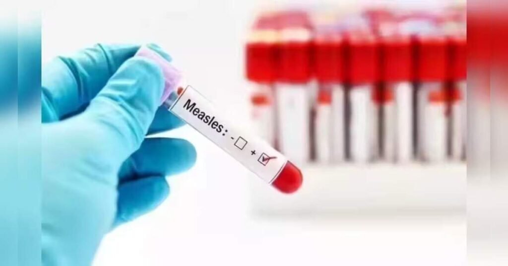 New York Declares Measles Disaster Emergency as Outbreak Surges, ETHealthworld