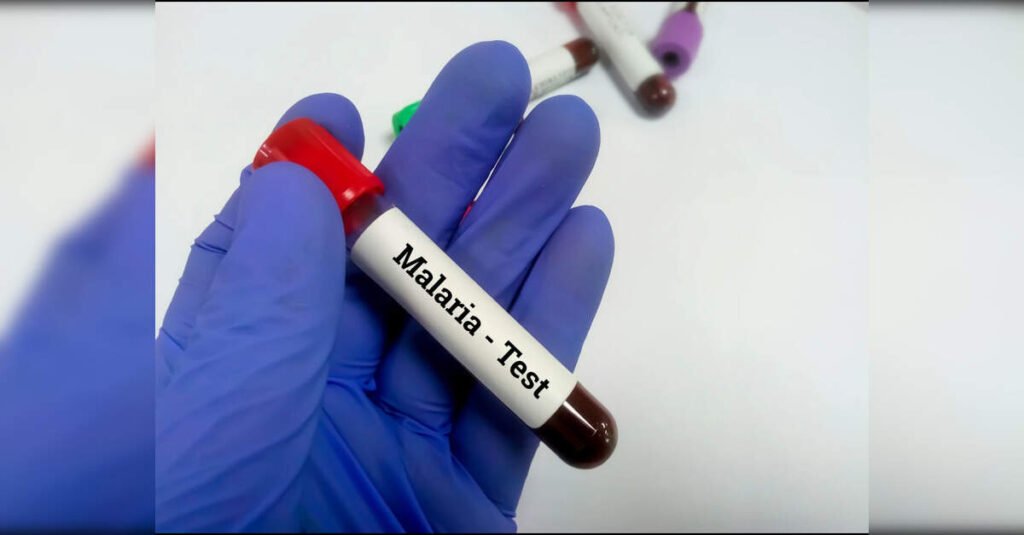 State intensifies malaria surveillance after 37,899 cases, 9 deaths, ETHealthworld