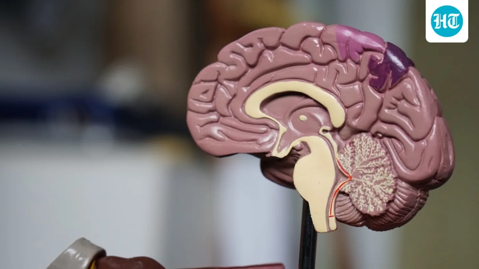 The skill nobody trains: Doctor explains why mental fitness is the foundation of peak performance
