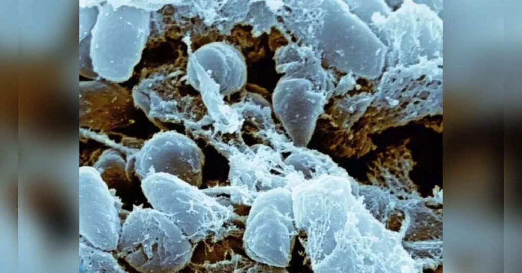 Russian regulator says no epidemic risks after death of plague institute worker, ETHealthworld