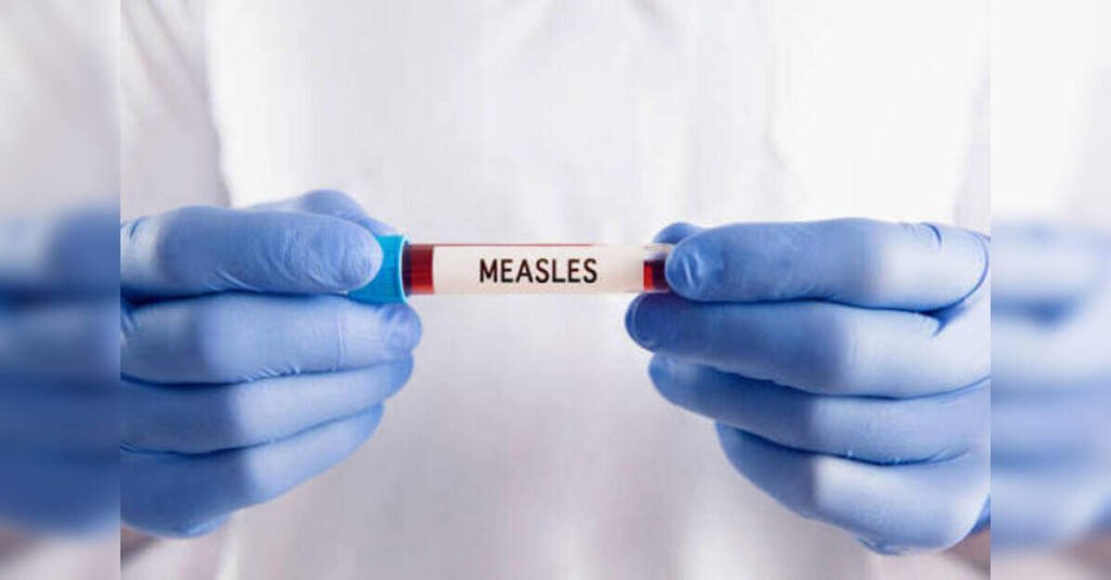 US Measles Cases Surge to 4,080 in 2026 Amid Outbreaks, ETHealthworld